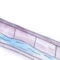 Ditch (557) illustration