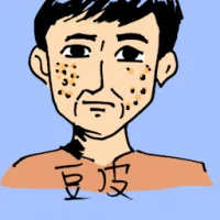 Pimple (0839) illustration