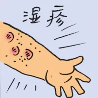 Eczema (2606) illustration