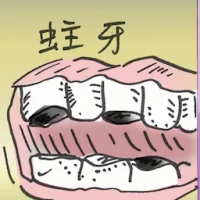 Decayed Tooth (2896) illustration