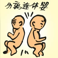 Separates Conjoined Twins (4245) illustration