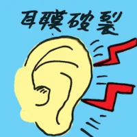 Ruptured Eardrum (4798) illustration