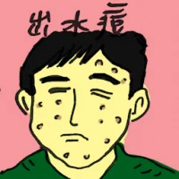 Chicken Pox (4875) illustration