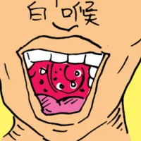 Diphtheria (Serious Nose And Throat Infection) (5202) illustration