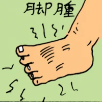 Swollen Leg (5356) illustration