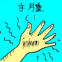 Swollen Hand (5369) illustration