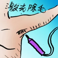 Laser Hair Removal (7778) illustration