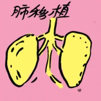 Lung Transplant (8200) illustration