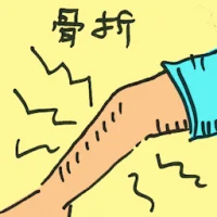 Fracture (8526) illustration