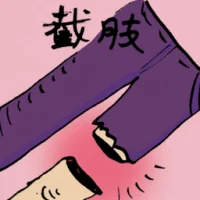 Amputation (8702) illustration