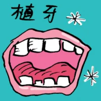 Dental Implant (8845) illustration