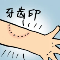 Teeth Mark (8846) illustration